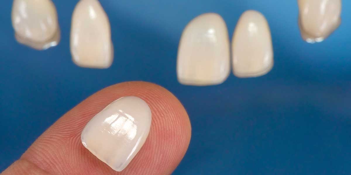 Keep your teeth and gums healthy