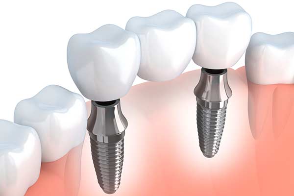 Comprehensive Dental Exam