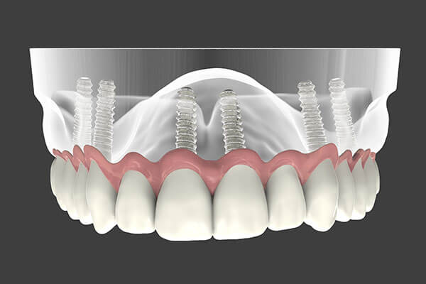 Keep your teeth and gums healthy