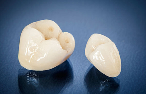 Restorative Dentistry