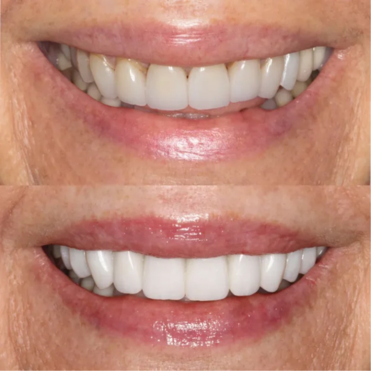 smile-2