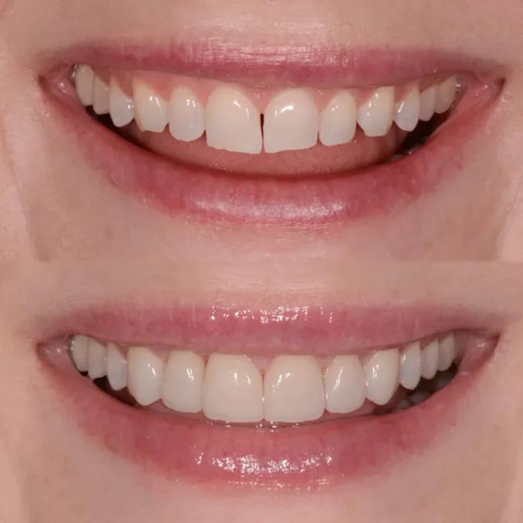smile-4