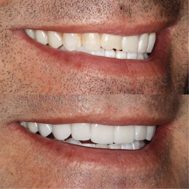 smile-6