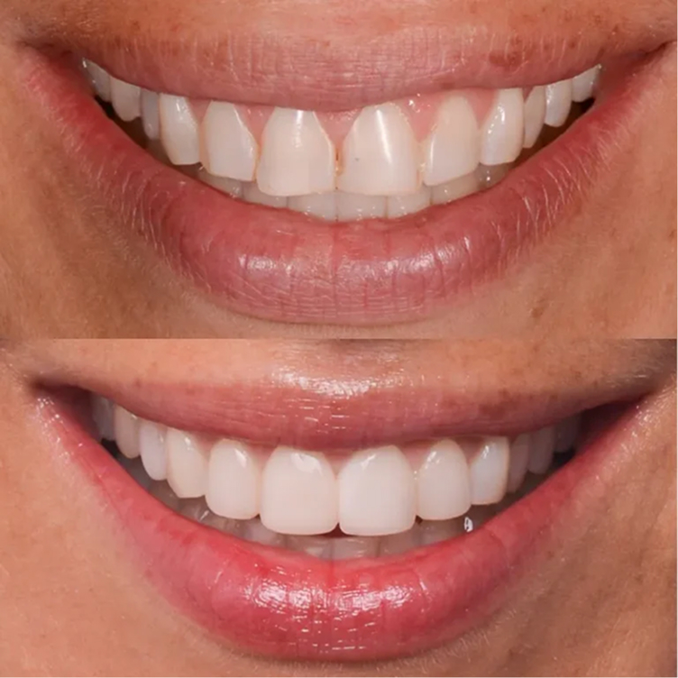 smile1