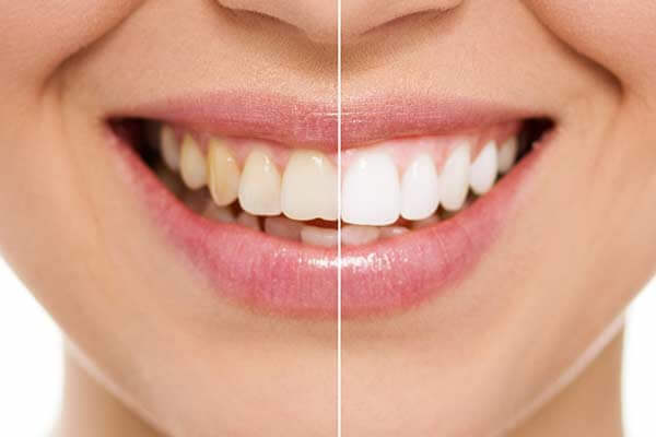 Restorative Dentistry