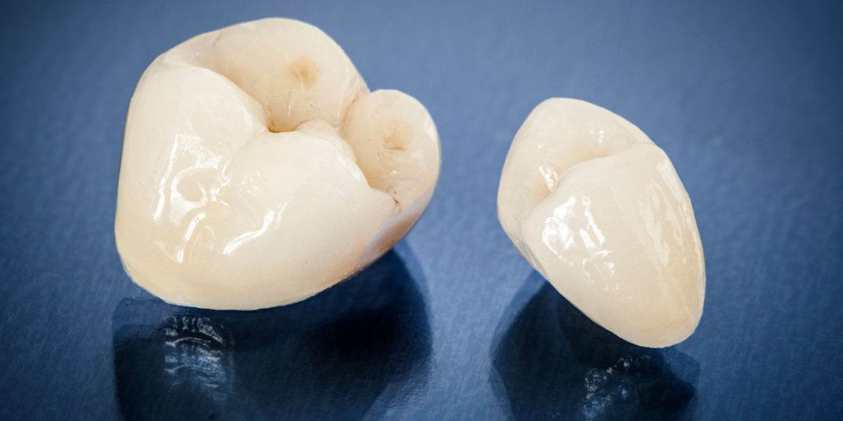 CEREC same-day crown at Greater Long Island Dental in Massapequa