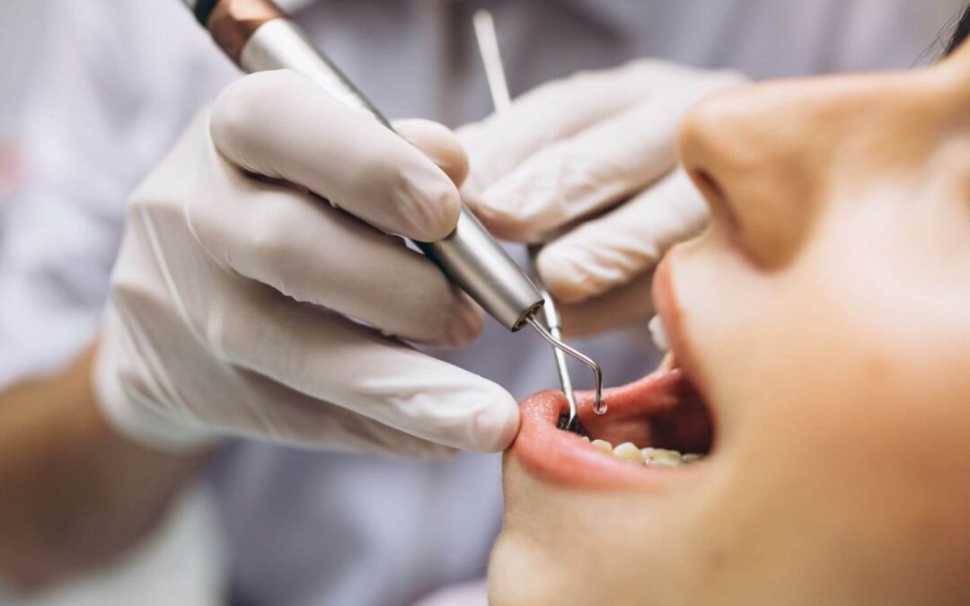 Should you have your wisdom teeth out?