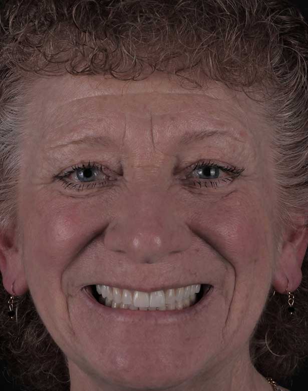 diane-gariglio-before-after Elena