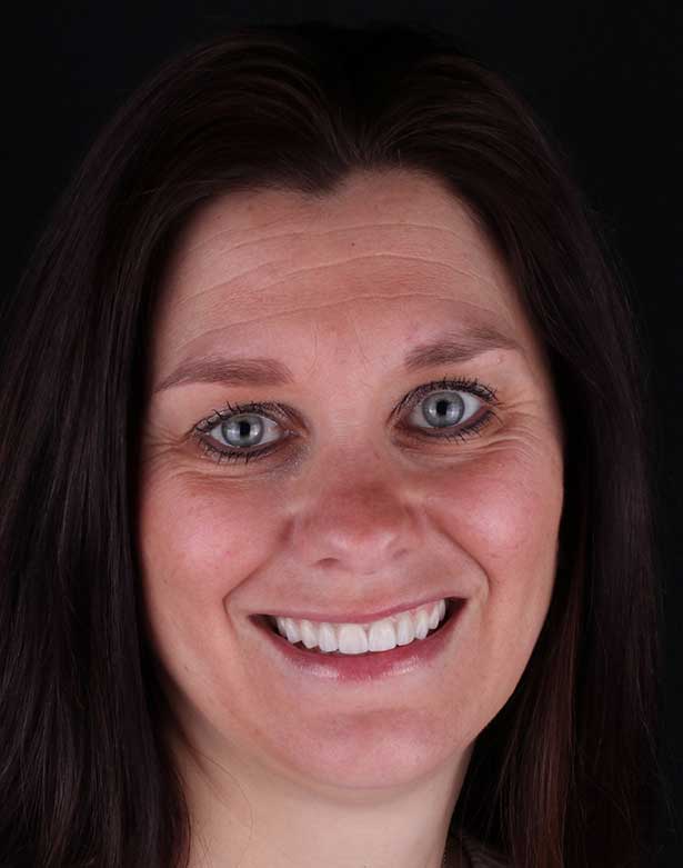 kerri-keefe-before-after Elena