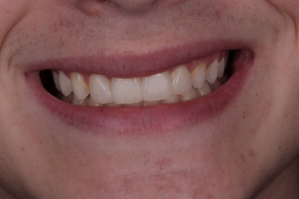 After Photo