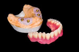 who offers the best dentures massapequa?