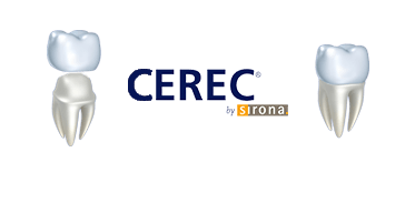 CEREC Image