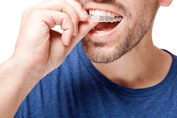 invisalign for teeth grinding greater long island dental